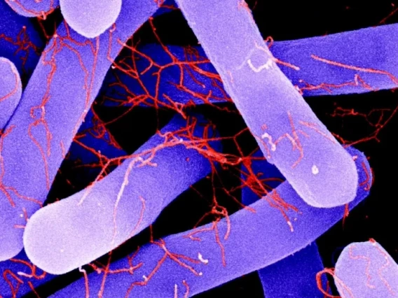 False-color image of C. difficile vegetative cell and Ruthenium Red-stained flagella.