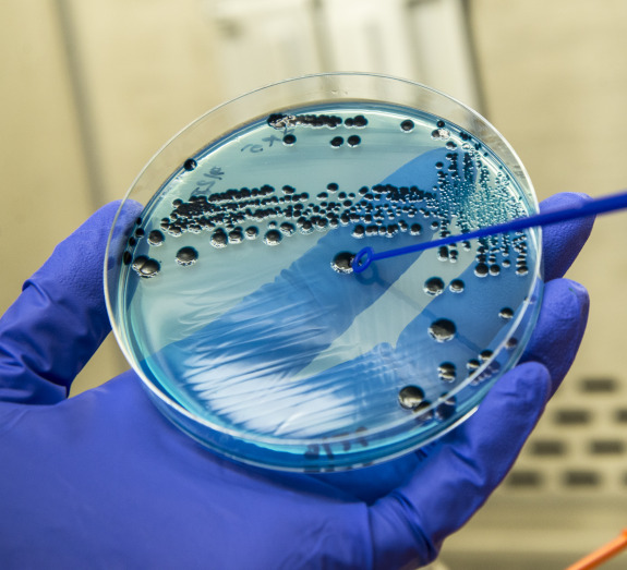 An entomologist nematod research in Petri dish