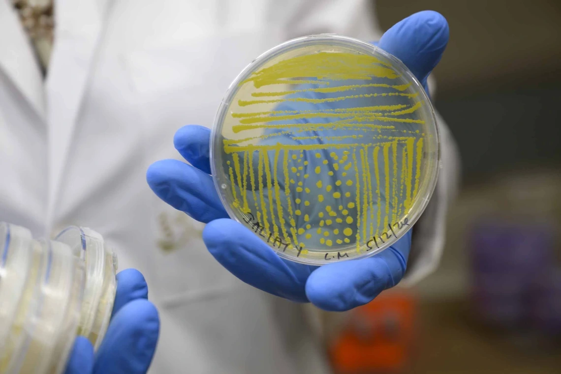 A petri dish with microbes