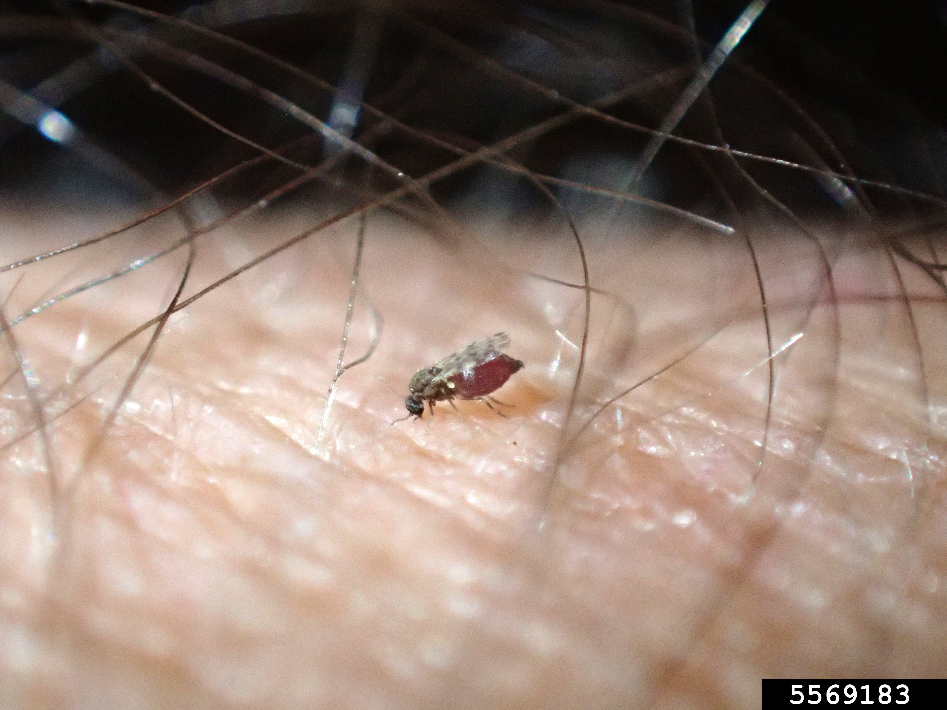 microscopic bug bites